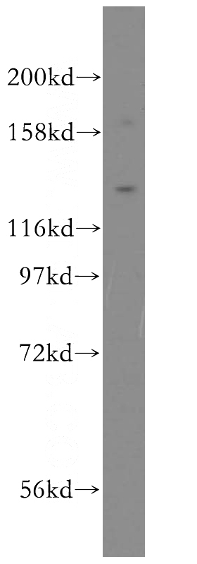 mouse lung tissue were subjected to SDS PAGE followed by western blot with Catalog No:116077(TLR7 antibody) at dilution of 1:400