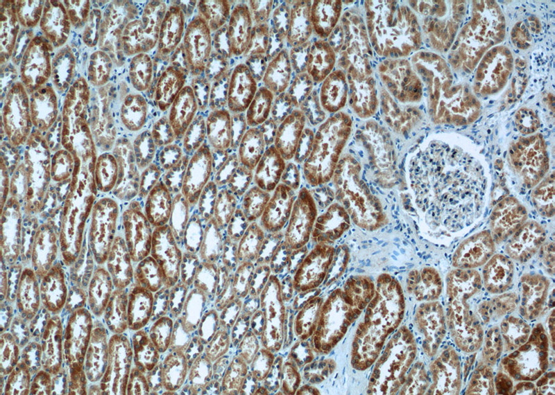 Immunohistochemistry of paraffin-embedded human kidney tissue slide using Catalog No:108751(CA7 Antibody) at dilution of 1:50 (under 10x lens)