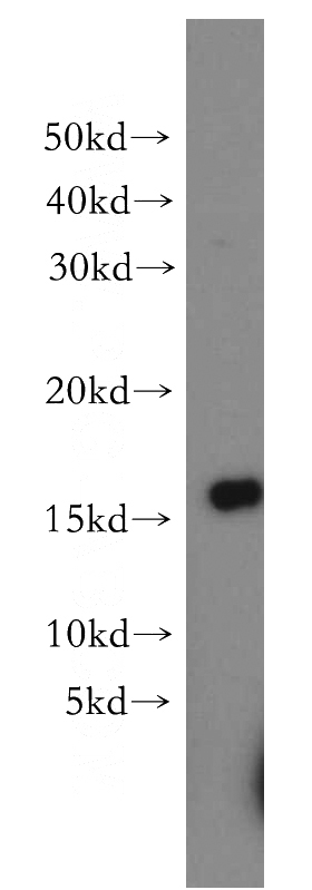 A549 cells were subjected to SDS PAGE followed by western blot with Catalog No:114338(PUMA antibody) at dilution of 1:500