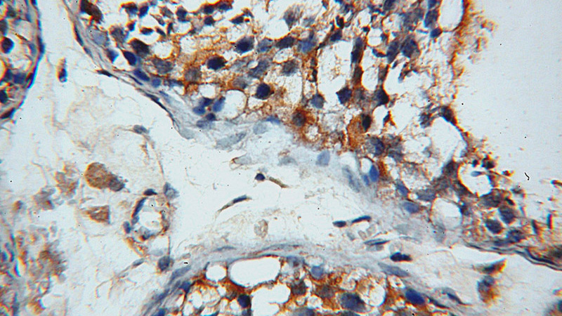 Immunohistochemical of paraffin-embedded human testis using Catalog No:109988(DLEC1 antibody) at dilution of 1:50 (under 40x lens)