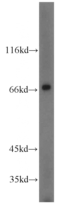 HeLa cells were subjected to SDS PAGE followed by western blot with Catalog No:110847(GALNT4 antibody) at dilution of 1:800