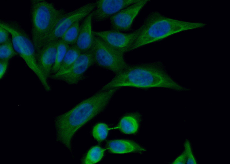 Immunofluorescent analysis of (10% Formaldehyde) fixed HeLa cells using Catalog No:116250(TOPBP1 Antibody) at dilution of 1:50 and Alexa Fluor 488-congugated AffiniPure Goat Anti-Rabbit IgG(H+L)