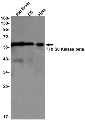 Western blot detection of P70 S6 Kinase beta in Rat Brain,C6,Hela cell lysates using P70 S6 Kinase beta Rabbit pAb(1:1000 diluted).Predicted band size:54kDa.Observed band size:54kDa.