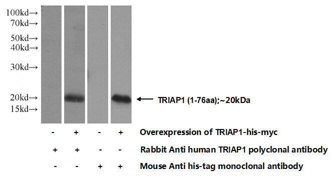 Transfected HEK-293 cells were subjected to SDS PAGE followed by western blot with Catalog No:116360(TRIAP1 Antibody) at dilution of 1:1000