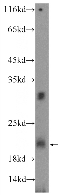 mouse bladder tissue were subjected to SDS PAGE followed by western blot with Catalog No:116343(TRAPPC2L Antibody) at dilution of 1:300