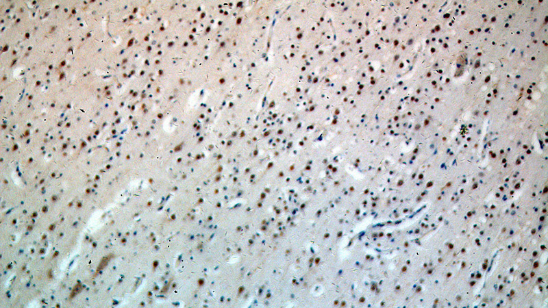 Immunohistochemical of paraffin-embedded human brain using Catalog No:114039(POLR2B-Specific antibody) at dilution of 1:400 (under 10x lens)