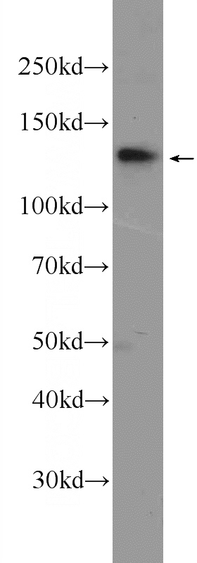 Jurkat cells were subjected to SDS PAGE followed by western blot with Catalog No:115046(SALL2 Antibody) at dilution of 1:1000