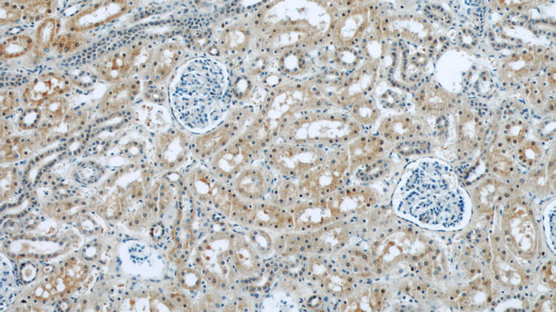 Immunohistochemical of paraffin-embedded human kidney using Catalog No:114097(PPP2R1A antibody) at dilution of 1:50 (under 10x lens)