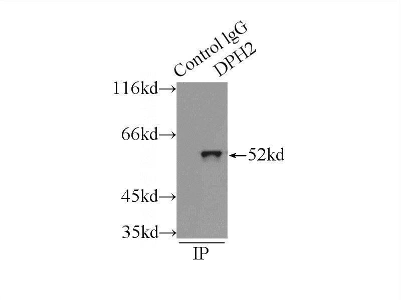 IP Result of anti-DPH2 (IP:Catalog No:110065, 3ug; Detection:Catalog No:110065 1:1000) with mouse skeletal muscle tissue lysate 6000ug.