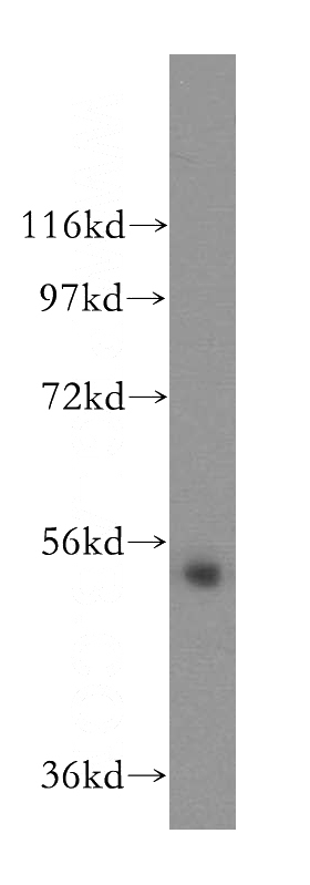 mouse uterus tissue were subjected to SDS PAGE followed by western blot with Catalog No:112618(MIER3 antibody) at dilution of 1:300