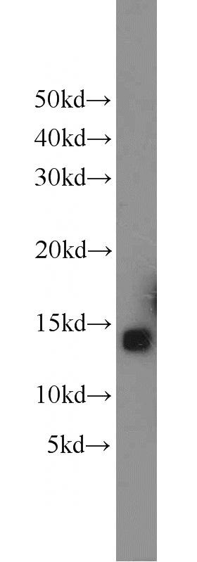 mouse liver tissue were subjected to SDS PAGE followed by western blot with Catalog No:109492(COX5B antibody) at dilution of 1:1000