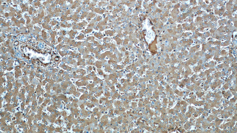 Immunohistochemical of paraffin-embedded human liver using Catalog No:116145(TNIP2 antibody) at dilution of 1:100 (under 10x lens)