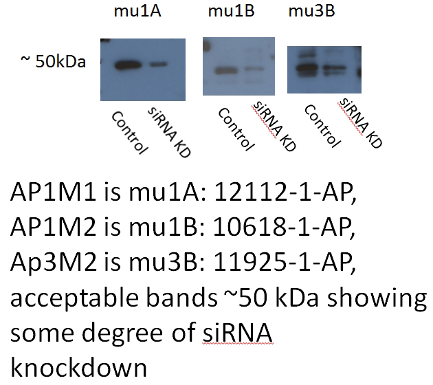 WB result of AP3M2 antibody (Catalog No:108125; 1:500) with siRNA cell lysate.