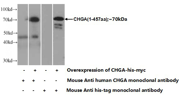 Transfected HEK-293 cells were subjected to SDS PAGE followed by western blot with Catalog No:107157(CHGA Antibody) at dilution of 1:500