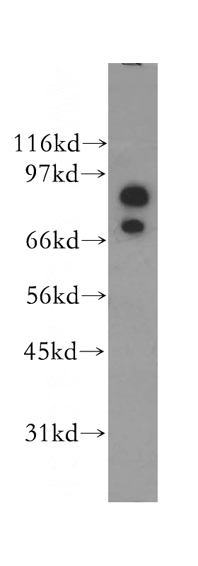 human brain tissue were subjected to SDS PAGE followed by western blot with Catalog No:110943(GPHN antibody) at dilution of 1:400