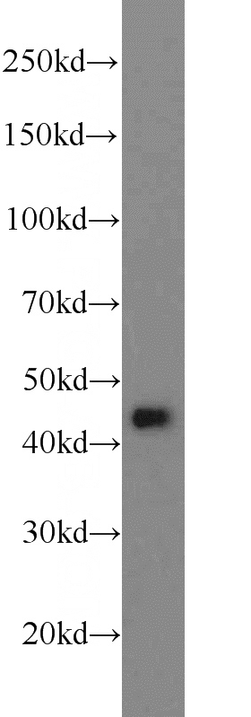HEK-293 cells were subjected to SDS PAGE followed by western blot with Catalog No:107894(ADRM1 antibody) at dilution of 1:1000