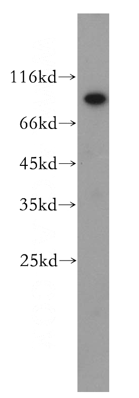 HeLa cells were subjected to SDS PAGE followed by western blot with Catalog No:116125(TIGD5 antibody) at dilution of 1:300