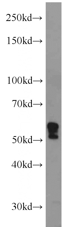 L02 cells were subjected to SDS PAGE followed by western blot with Catalog No:112277(LAMP2 antibody) at dilution of 1:300