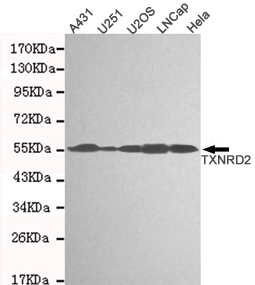Western blot detection of TXNRD2 in A431,U251,U2OS,Lncap and Hela cell lysates and using TXNRD2 mouse mAb (1:1000 diluted).Predicted band size: 56KDa.Observed band size: 56KDa.