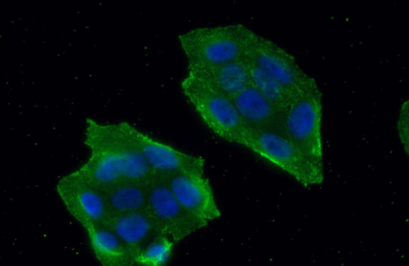 Immunofluorescent analysis of (10% Formaldehyde) fixed HeLa cells using Catalog No:107412(MALT1 Antibody) at dilution of 1:100 and Alexa Fluor 488-congugated AffiniPure Goat Anti-Mouse IgG(H+L)