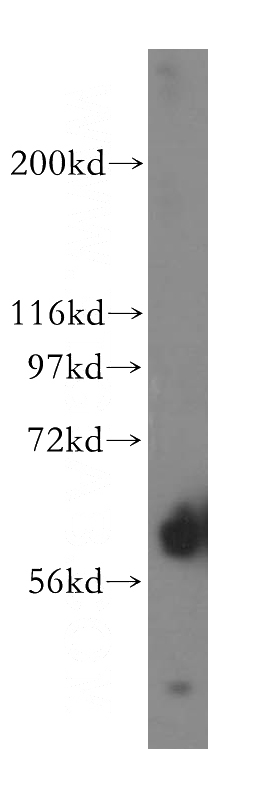 human liver tissue were subjected to SDS PAGE followed by western blot with Catalog No:110730(FMO5 antibody) at dilution of 1:1200