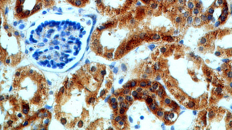 Immunohistochemical of paraffin-embedded human kidney using Catalog No:111875(IVNS1ABP antibody) at dilution of 1:100 (under 40x lens)