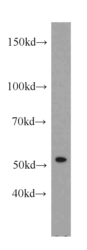 A431 cells were subjected to SDS PAGE followed by western blot with Catalog No:114588(RBBP7 antibody) at dilution of 1:300