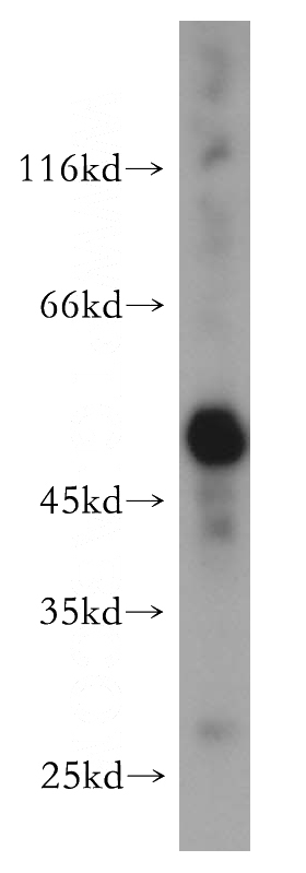 mouse liver tissue were subjected to SDS PAGE followed by western blot with Catalog No:107958(ALDH1A1 antibody) at dilution of 1:400