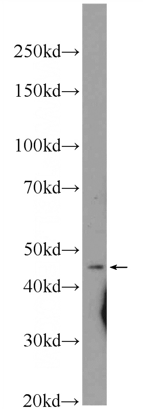 Y79 cells were subjected to SDS PAGE followed by western blot with Catalog No:108218(ASCC1 Antibody) at dilution of 1:600