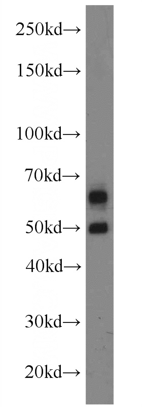 mouse brain tissue were subjected to SDS PAGE followed by western blot with Catalog No:108916(CAMK2B antibody) at dilution of 1:1000