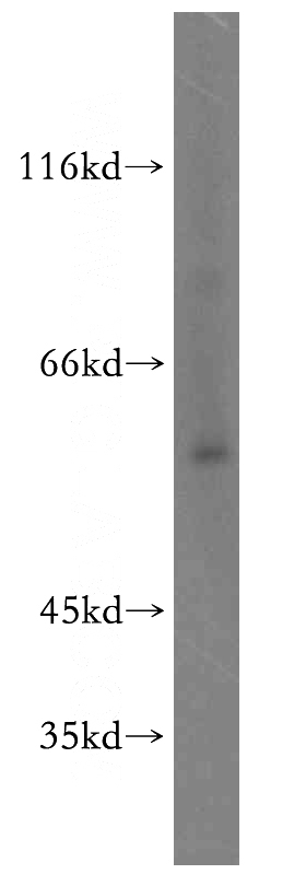 Raji cells were subjected to SDS PAGE followed by western blot with Catalog No:111282(HCK antibody) at dilution of 1:100