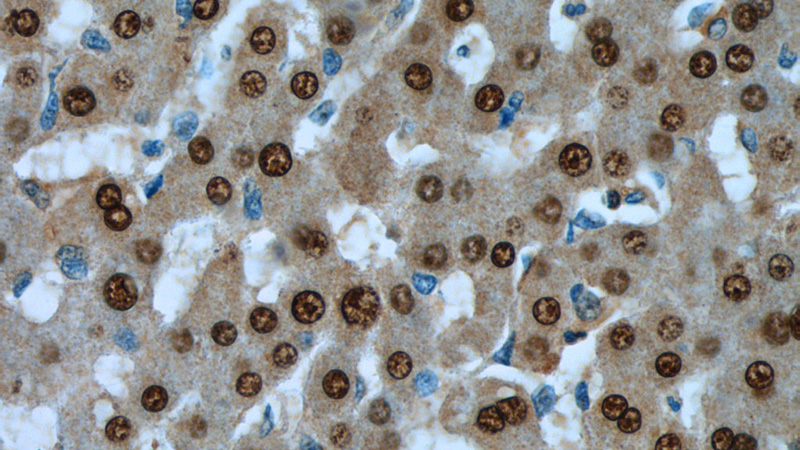 Immunohistochemistry of paraffin-embedded human liver tissue slide using Catalog No:113349(ONECUT1 Antibody) at dilution of 1:50 (under 40x lens)