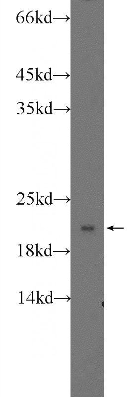 HeLa cells were subjected to SDS PAGE followed by western blot with Catalog No:114906(RPLP1 Antibody) at dilution of 1:1000