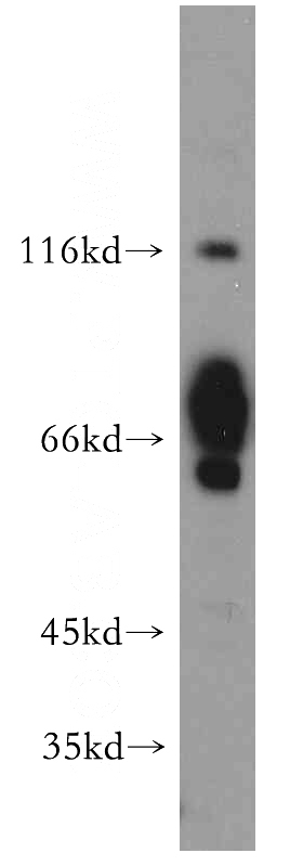 L02 cells were subjected to SDS PAGE followed by western blot with Catalog No:110699(FOXJ3 antibody) at dilution of 1:500