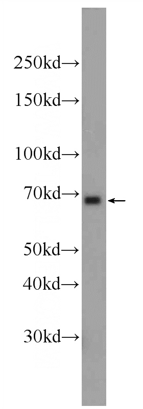 Jurkat cells were subjected to SDS PAGE followed by western blot with Catalog No:114566(RBPJL Antibody) at dilution of 1:1500