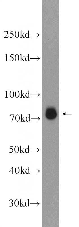 A549 cells were subjected to SDS PAGE followed by western blot with Catalog No:111828(IRAK1 Antibody) at dilution of 1:600