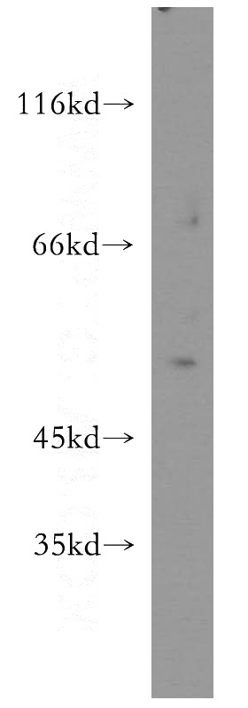 mouse colon tissue were subjected to SDS PAGE followed by western blot with Catalog No:113581(F2RL1 antibody) at dilution of 1:300