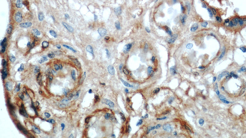 Immunohistochemical of paraffin-embedded human placenta using Catalog No:107582(AMOT antibody) at dilution of 1:100 (under 40x lens)