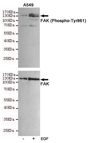 Western blot analysis of extracts from A549 cells, untreated or treated with EGF(10ng/ml,10min), using FAK (Phospho-Tyr861) Rabbit pAb (167135,1:500 diluted,upper) and FAK Mouse mAb (200899,lower).