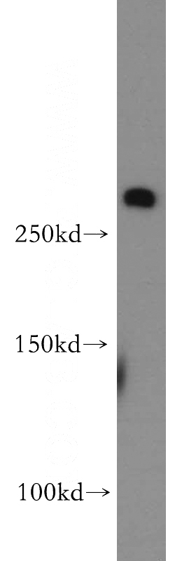 human brain tissue were subjected to SDS PAGE followed by western blot with Catalog No:110655(FBN2-Specific antibody) at dilution of 1:500