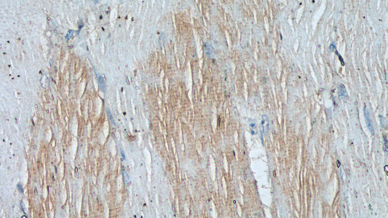 Immunohistochemistry of paraffin-embedded human skeletal muscle tissue slide using Catalog No:116150(TNNI1 Antibody) at dilution of 1:50 (under 40x lens)