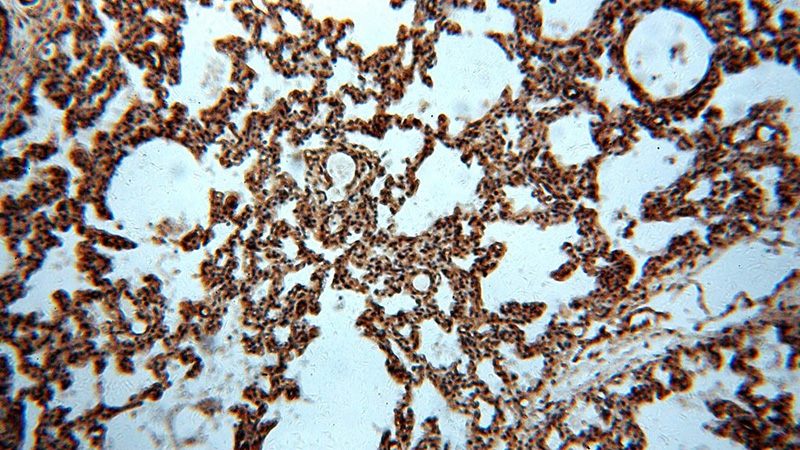 Immunohistochemical of paraffin-embedded human lung using Catalog No:112494(MAT2B antibody) at dilution of 1:100 (under 10x lens)