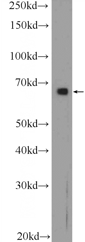 HeLa cells were subjected to SDS PAGE followed by western blot with Catalog No:108097(ANXA6 Antibody) at dilution of 1:1000