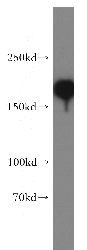 HeLa cells were subjected to SDS PAGE followed by western blot with Catalog No:115427(SMARCA4 antibody) at dilution of 1:800