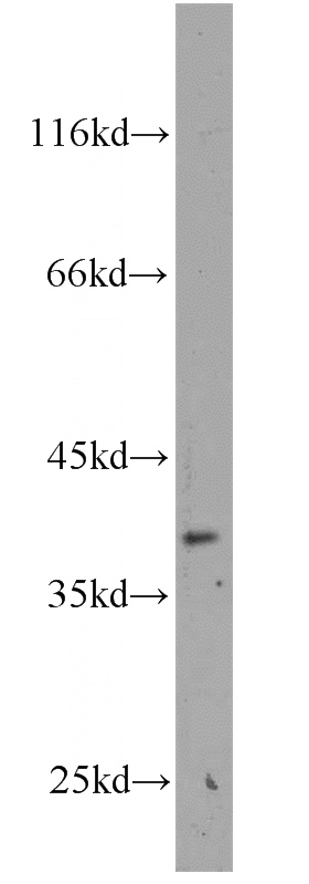 mouse brain tissue were subjected to SDS PAGE followed by western blot with Catalog No:112363(MAB21L2 antibody) at dilution of 1:200