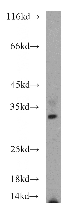 PC-3 cells were subjected to SDS PAGE followed by western blot with Catalog No:113590(PARP11 antibody) at dilution of 1:500