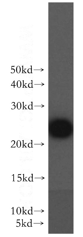 HeLa cells were subjected to SDS PAGE followed by western blot with Catalog No:116574(UCN antibody) at dilution of 1:300
