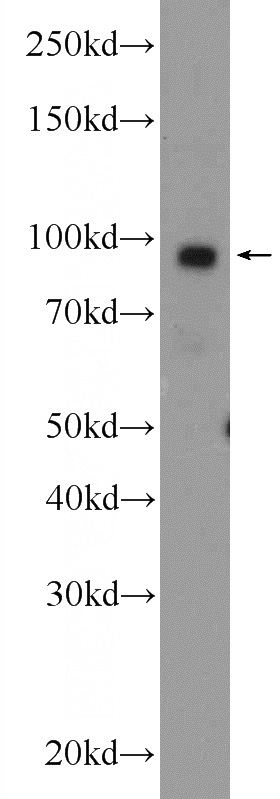MCF-7 cells were subjected to SDS PAGE followed by western blot with Catalog No:108286(ATF6 Antibody) at dilution of 1:3000