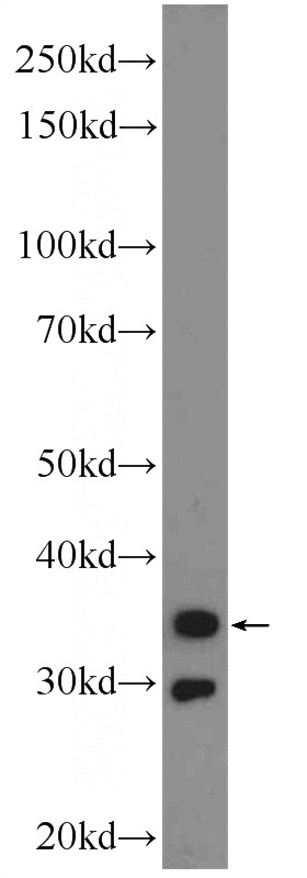 mouse stomach tissue were subjected to SDS PAGE followed by western blot with Catalog No:108906(Calponin Antibody) at dilution of 1:3000