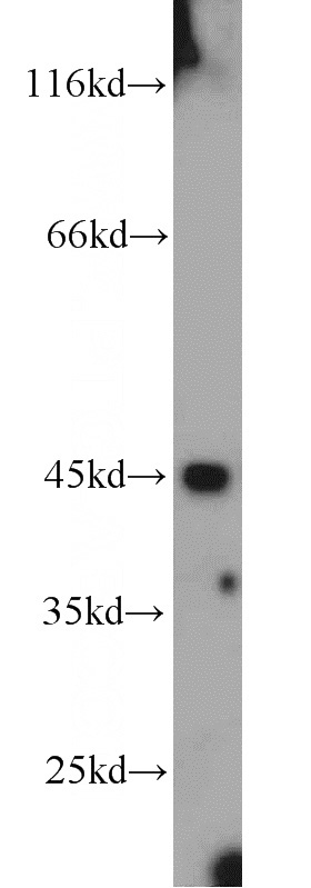 human brain tissue were subjected to SDS PAGE followed by western blot with Catalog No:111956(ITPK1 antibody) at dilution of 1:300